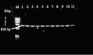 Image for - Transgenic Banana Rastali (AAB) with β-1, 3-glucanase Gene for Tolerance to Fusarium Wilt Race 1 Disease via Agrobacterium-mediated Transformation System