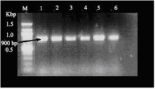 Image for - Transgenic Banana Rastali (AAB) with β-1, 3-glucanase Gene for Tolerance to Fusarium Wilt Race 1 Disease via Agrobacterium-mediated Transformation System