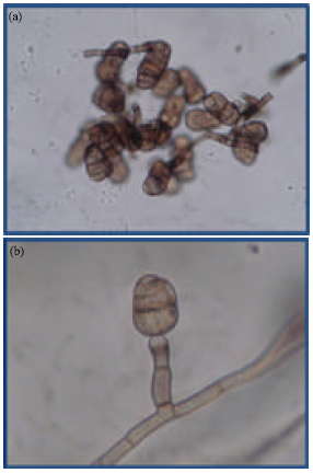 Image for - Physiological Study and both in vitro and in vivo Antifungal Activities against Stemphylium botryosum causing Stemphylium Blight Disease in Lentil (Lens culinaris)