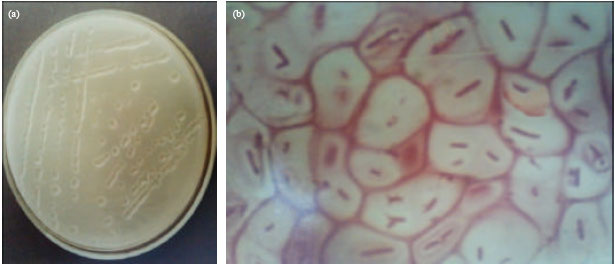Image for - New Findings on Biological Control Trials of Potato Brown Rot with Antagonistic  Strains of Bacillus circulans, in Egypt
