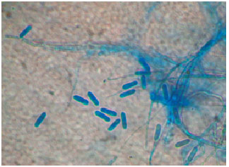 Image for - Control of Anthracnose Disease in Swietenia macrophylla using Trichoderma virideas Biocontrol Agent