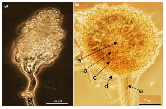 Image for - Diversity of Ascomycetes at the Potato Interface: New Devastating Fungal Pathogens Posing Threat to Potato Farming