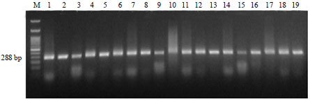 Image for - Detection and Molecular Characterization of some Egyptian Isolates of Ralstonia solanacearum by Nested-PCR and PCR-RFLP Analyses