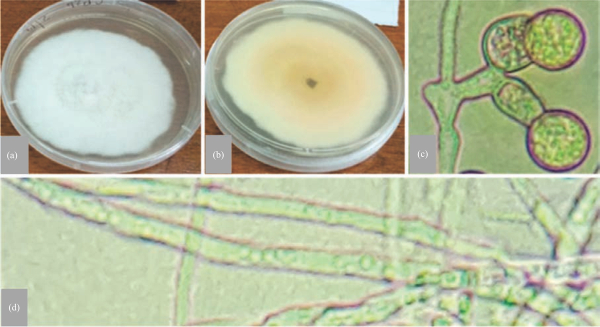 Image for - Morphological and Molecular Characterization of Alternaria solani and Phytophthora infestans Isolates from Tomato Farms in Kenya