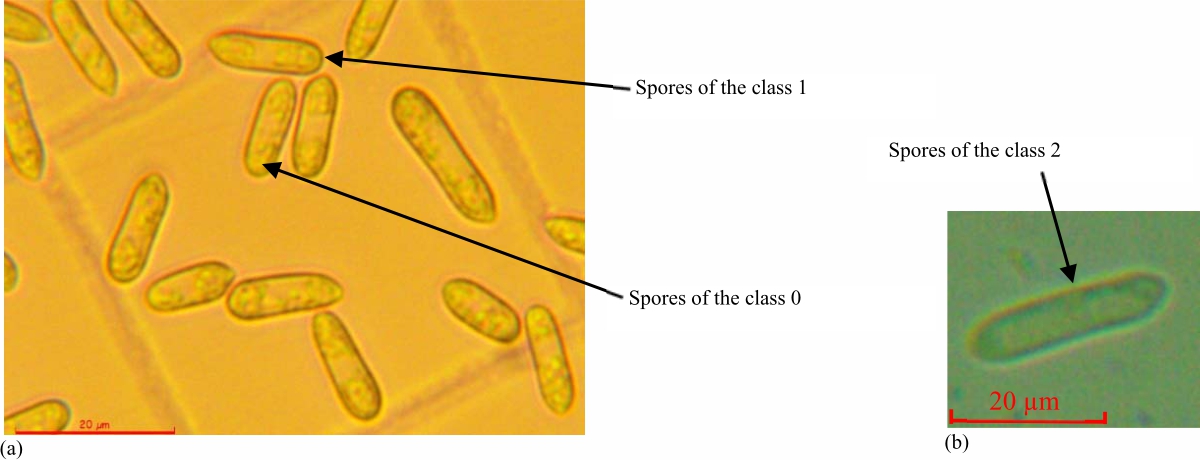 Image for - Morphometric Analysis of Isolated Conidia of Various Species of Colletotrichum sp. from Avocado and Mango in Côte d'Ivoire