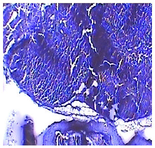 Image for - Gastro Protective and Antioxidant Activity of Solanum nigrum Linn. against Aspirin and Cold Restraint Stress induced Ulcerated Rats