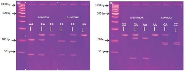 Image for - Interleukins-10 and 18 Genes Polymorphisms in Hepatitis B Virus Infected Saudi Patients