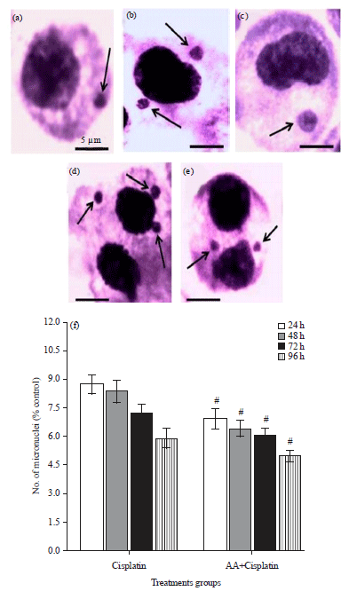 Image for - Ascorbic Acid (Vitamin C)-Mediated Protection on Mutagenic Potentials of Cisplatin in Mice Bearing Ascites Dalton’s Lymphoma