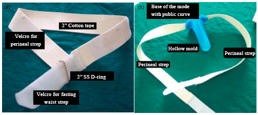 Image for - Novel Mold and Harness to Optimize Success of Vaginal Reconstruction in Transverse Vaginal Septum