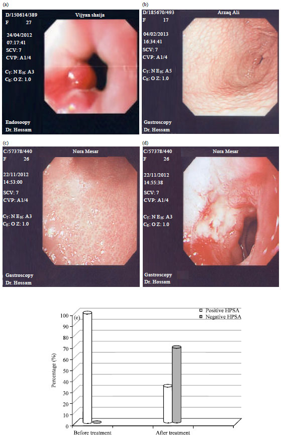 Image for - Role of Helicobacter pylori Eradication in the Management of Hyperemesis Gravidarum