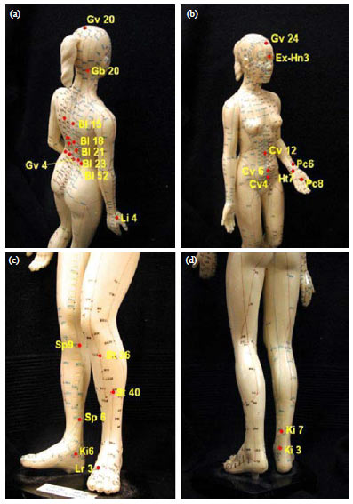 Image for - Laser Acupuncture Therapy: An Alternative Treatment to Mitigate the Menopausal Hot Flashes Symptom