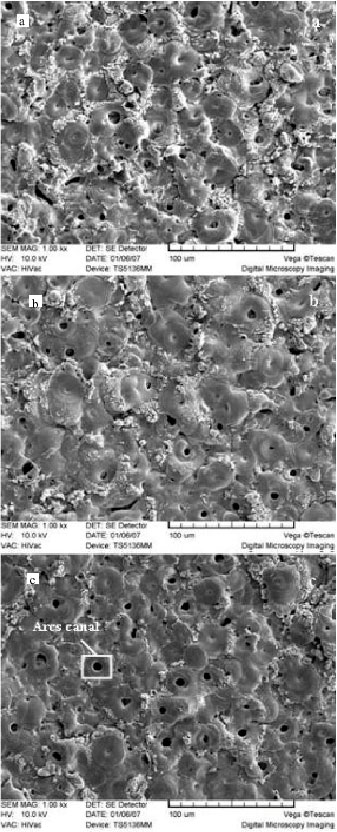 Image for - Deposition of Oxide Layer on Aluminium Via Plasma Electrolysis Method in Alkali Solutions by Unipolar Pulsed Current System and Study of its Physical Properties