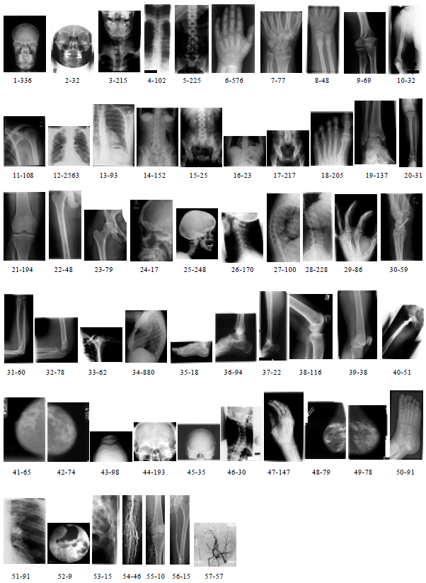 Image for - Improving the Annotation Accuracy of Medical Images in ImageCLEFmed2005  Using K-Nearest Neighbor (kNN) Classifier