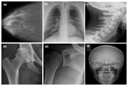 Image for - Medical Image Classification Using Multi-Vocabulary