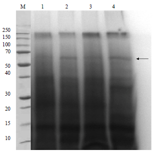 Image for - Comparison of Protein Isolation Methods from Brassica napus subsp. oleifera Seeds Growing in Turkey
