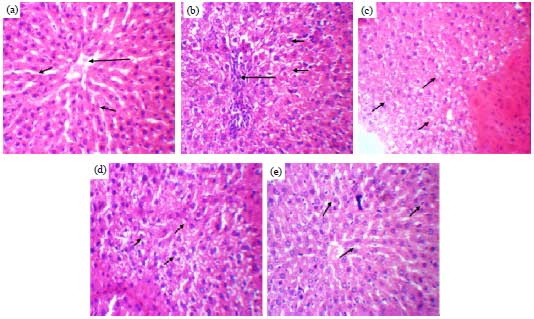Image for - Investigation of Acute and Sub-chronic Toxicity of Aqueous Extract of Nigerian Nasal Snuff in Wistar Albino Rats
