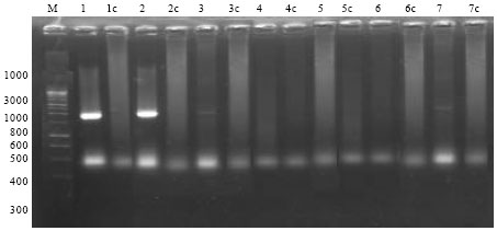 Image for - Evaluation of Some Faba Bean Genotypes against Chocolate Spot Disease Using cDNA Fragments of Chitinase Gene and Some Traditional Methods