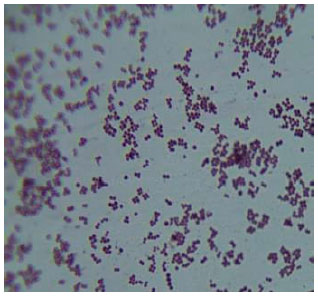 Incidence and Pattern of Antibiotic Resistance of Staphylococcus aureus ...