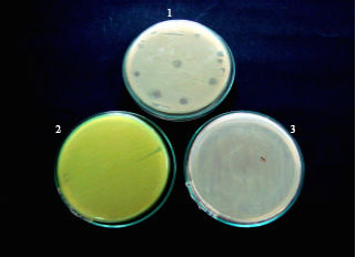 Image for - Isolation of Host-Specific Bacteriophages from Sewage Against Human Pathogens