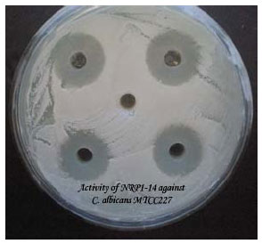 Image for - Screening of Local Actinomycete Isolates in Manipur for Anticandidal Activity