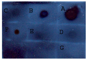 Image for - Construction of a Recombinant Fab Fragment of a Monoclonal Antibody against Leptin Receptor