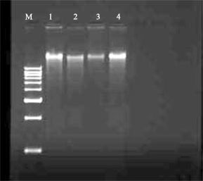 Image for - An Improved DNA Extraction Protocol from Four in vitro Banana Cultivars