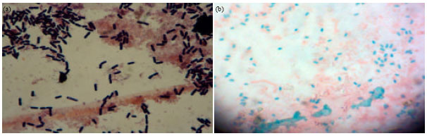 Image for - Decolorization of Synthetic Dyes Using Bacteria Isolated from Textile Industry Effluent