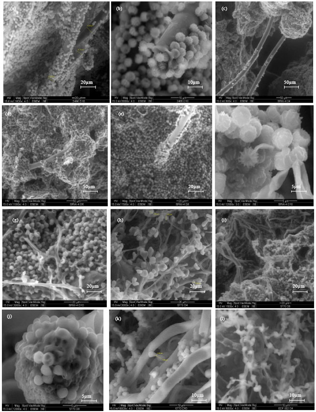 Image for - Relationship between Fungal Growth Morphologies and Ability to Secrete Lipase in Solid State Fermentation