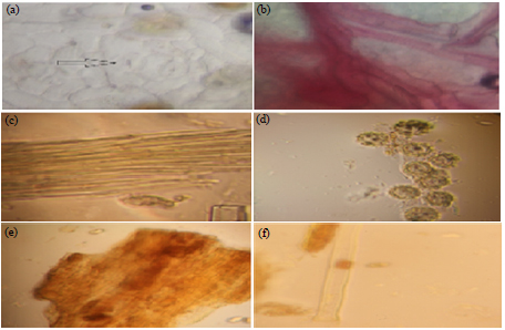 Pharmacognostical, Antibacterial and Antioxidant Studies of Aerial ...