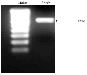 Image for - Detection of Mixed Infection of Tobamoviruses in Tomato and Bell Pepper by using RT-PCR and Duplex RT-PCR