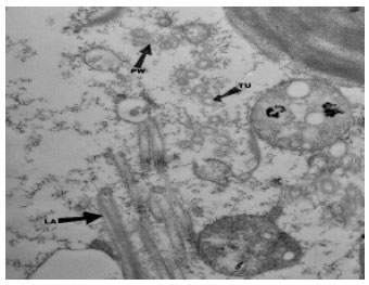 Image for - Characterization and Identification of a Potyvirus Causing Mosaic Disease of Cucurbita moschata Duch Ex. Poir in Calabar, South East Nigeria