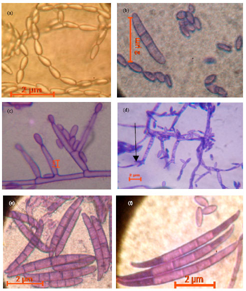 Image for - Diversity of Gibberella fujikuroi Species Complex Isolated from Maize Produced in Uganda