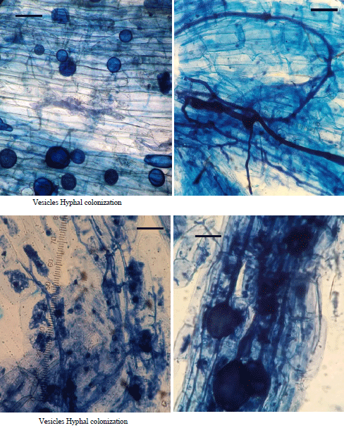 Image for - Arbuscular Mycorrhizal Fungi (AMF) Status and Diversity Of weedy Plants in Degraded Land
