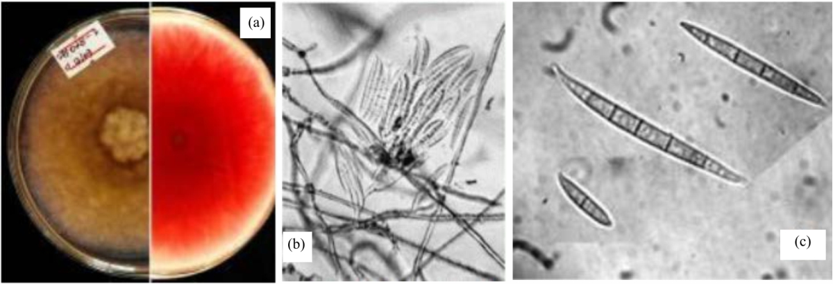 Image for - Identification of Fusarium Species Responsible to Cause Wheat Head Blight in Southwestern Ethiopia