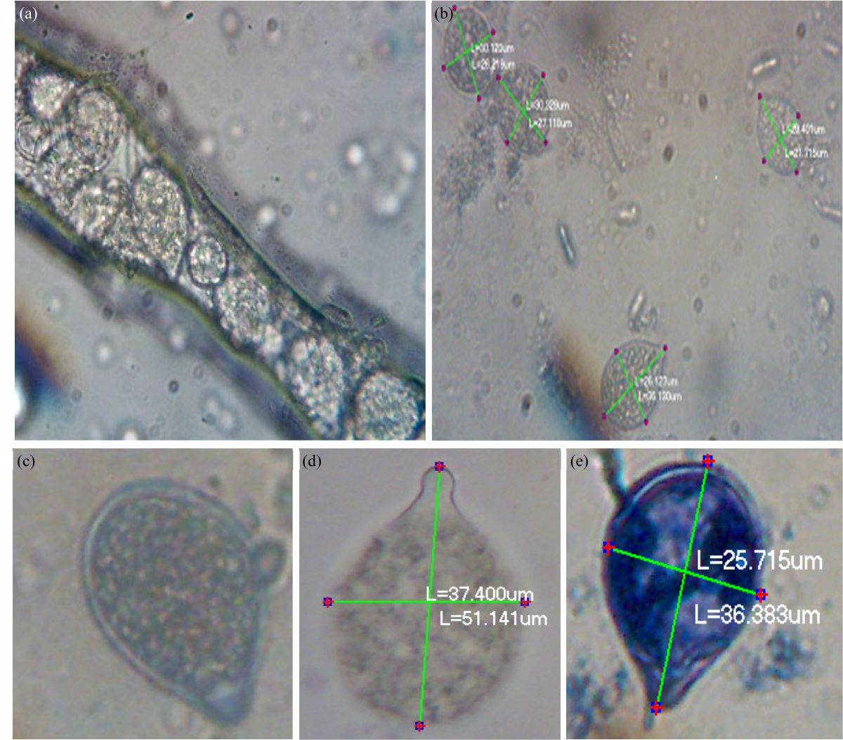 Image for - Molecular Characterization of Phytophthora Pod Rot of Cocoa (Theobroma cacao L.) in Southwestern Nigeria