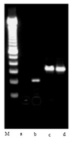 Image for - Presence of an Intron Indicated in a Candida krusei Tec1 Gene: A Preliminary Report