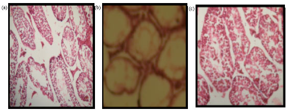Image for - Anti-spermatogenic Activity of Butea monosperma (Lam.) Kuntze Root
