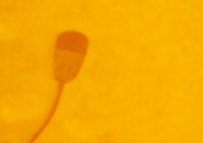 Image for - Determination of the Arabian Sand Gazelle Sperm and Acrosomes Defects by Using the Spermac Staining Technique