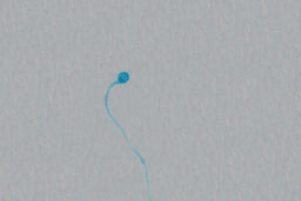 Image for - Determination of the Arabian Sand Gazelle Sperm and Acrosomes Defects by Using the Spermac Staining Technique