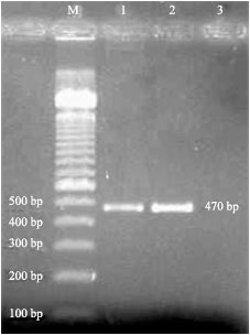 Image for - Development of Multiplex PCR (Polymerase Chain Reaction) Method for Detection of Salmonella spp. and Vibrio parahaemolyticus from Shrimp Samples of Bangladesh