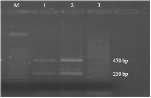 Image for - Development of Multiplex PCR (Polymerase Chain Reaction) Method for Detection of Salmonella spp. and Vibrio parahaemolyticus from Shrimp Samples of Bangladesh