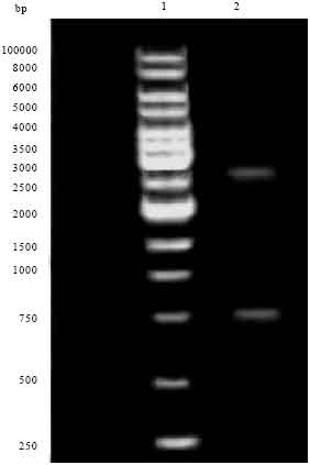 Image for - Expression of Complete Rhoptry Protein 1 (ROP1) Gene of Toxoplasma gondii 
  in Eukaryotic Cell