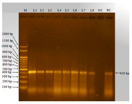 Image for - Characterization of Bovine Subclinical Mastitis Caused by Staphylococcus aureus in Southern Bangladesh by Bacteriological and Molecular Approaches