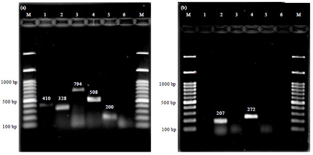 Image for - Frequency of Adhesive Virulence Factors in Carbapenemase-producing Acinetobacter baumannii Isolated from Clinical Samples in West of Iran