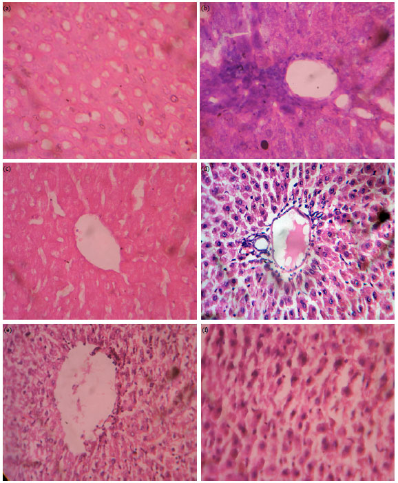 Image for - Hepatoprotective Activity of Bridelia retusa against Paracetamol-induced Liver Damage in Swiss Albino Mice