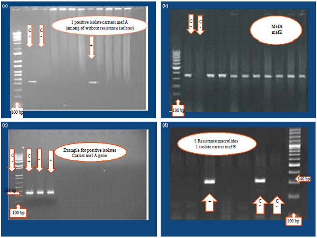 Image for - Antibiotic Resistance and Molecular Analysis of Streptococcus pyogenes  Isolated from Iranian Patients