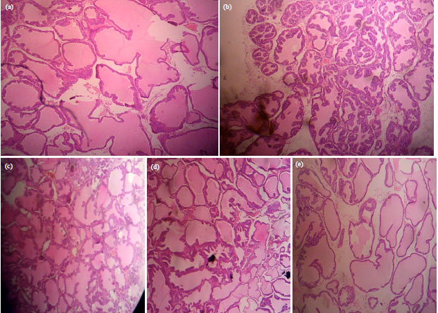 Image for - Prostate Specific Antigen, Antioxidant and Hematological Parameters in Prostatic Rats Fed Solanum macrocarpon L. Leaves