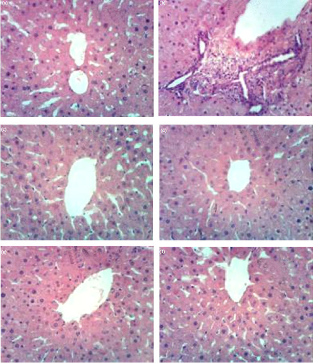 Image for - Isolation of Astragaloside-IV and Cyclocephaloside-I from Astragalus gummifera and Evaluation of Astragaloside-IV on CCl4 Induced Liver Damage in Rats
