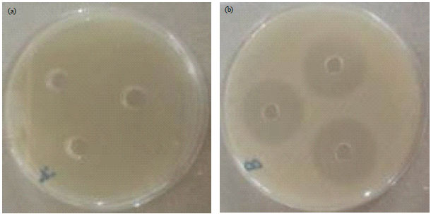 Image for - Stability of Epigallocatechin Gallate (EGCG) from Green Tea (Camellia sinensis) and its Antibacterial Activity against Staphylococcus epidermidis ATCC 35984 and Propionibacterium acnes ATCC 6919