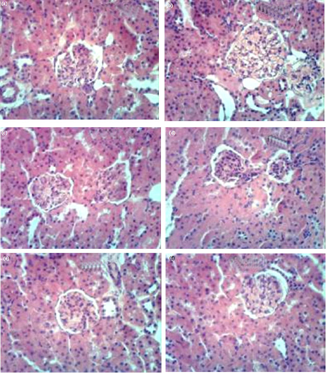 Image for - Isolation of Astragaloside-IV and Cyclocephaloside-I from Astragalus gummifera and Evaluation of Astragaloside-IV on CCl4 Induced Liver Damage in Rats